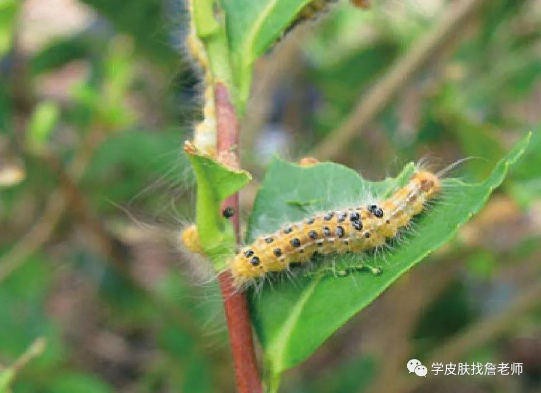 毛虫皮炎 一根毒毛引起的皮炎 严重者可导致失明 附上治疗方法 学皮肤找詹老师 微信公众号文章阅读 Wemp