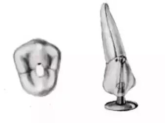 全口开髓标准图，值得收藏！