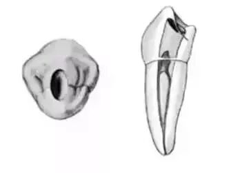 全口开髓标准图，值得收藏！