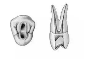 全口开髓标准图，值得收藏！