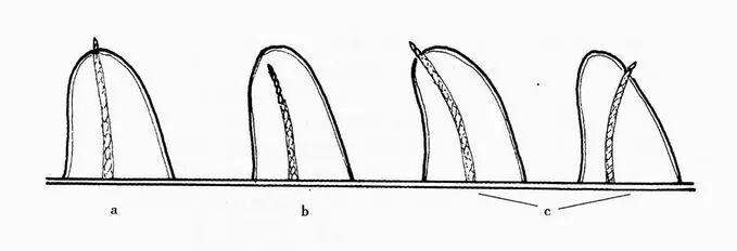 口腔H锉怎么消毒牙科医生必须看看----经典根管治疗总结_https://www.jmylbn.com_新闻资讯_第2张
