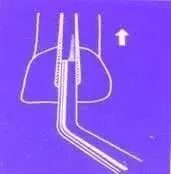 牙胶尖什么颜色最全整理 ｜ 根管治疗标准步骤和细节把握_https://www.jmylbn.com_新闻资讯_第22张