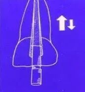 牙胶尖什么颜色最全整理 ｜ 根管治疗标准步骤和细节把握_https://www.jmylbn.com_新闻资讯_第20张