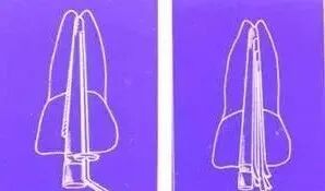 牙胶尖什么颜色最全整理 ｜ 根管治疗标准步骤和细节把握_https://www.jmylbn.com_新闻资讯_第21张