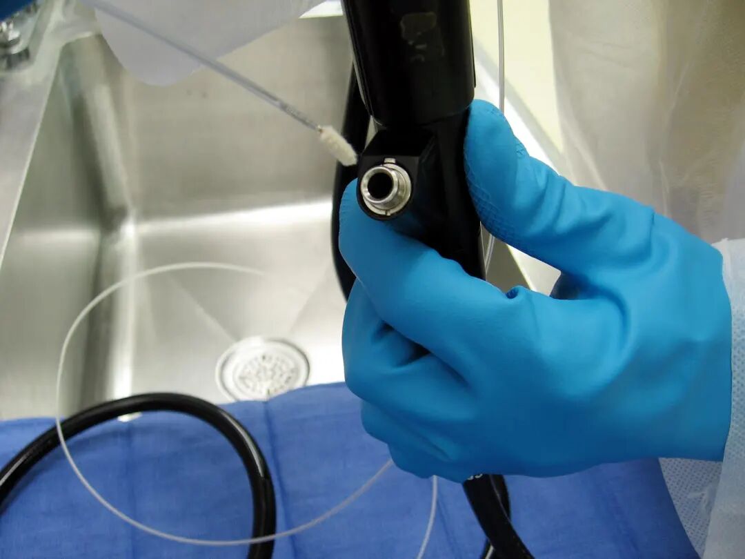 做完支气管镜怎么保养支气管镜如何维护与保养？_https://www.jmylbn.com_新闻资讯_第15张