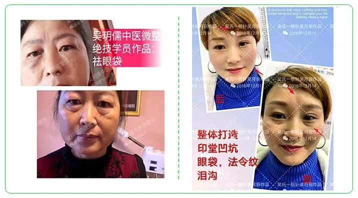 中医无绝症·中医微整绝技无恢复期