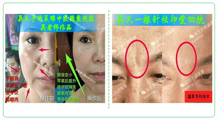 中医无绝症·中医微整绝技无恢复期