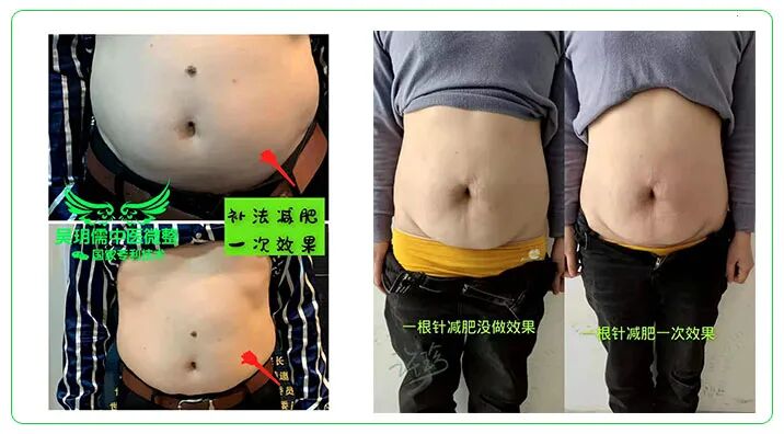 中医无绝症·中医微整绝技无恢复期