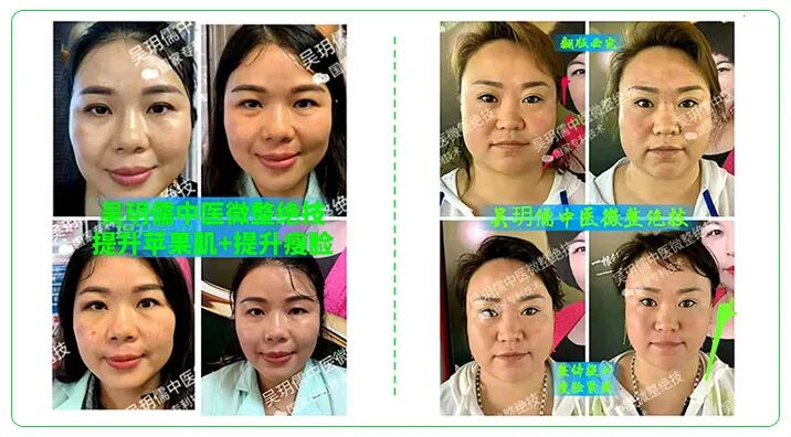 中医无绝症·中医微整绝技无恢复期