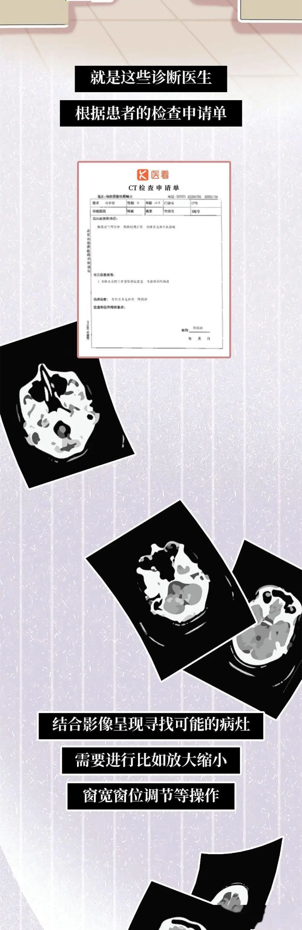 x光机为什么影像科诊断报告为什么那么慢？_https://www.jmylbn.com_新闻资讯_第11张