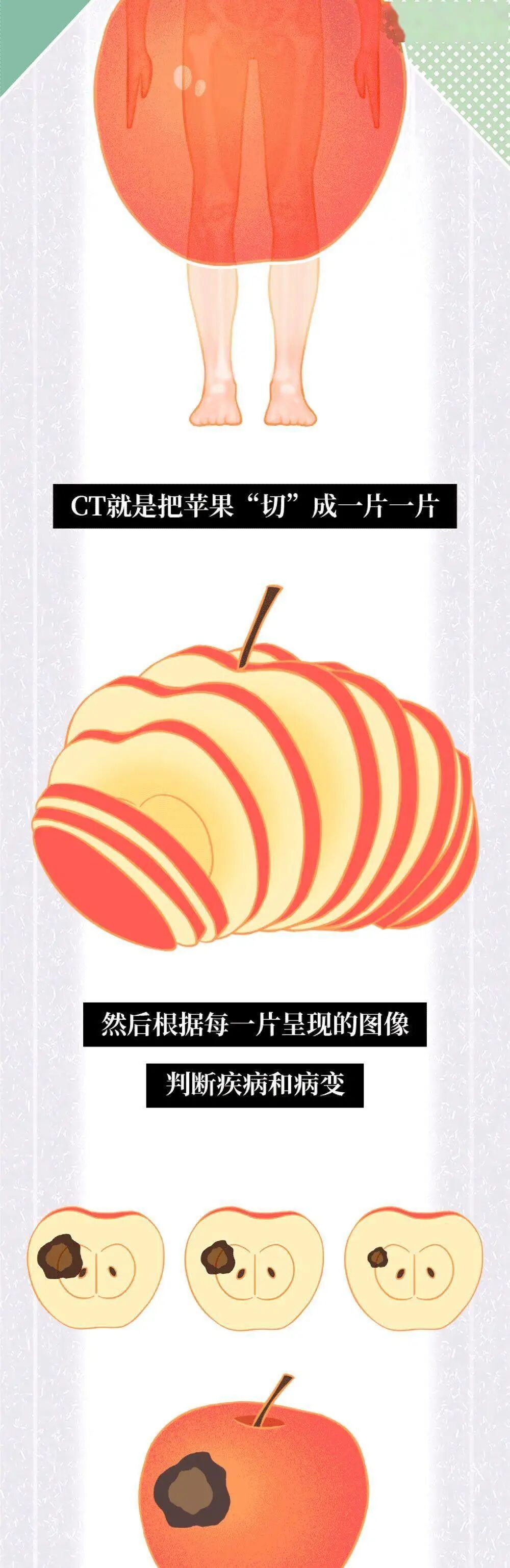 x光机为什么影像科诊断报告为什么那么慢？_https://www.jmylbn.com_新闻资讯_第6张