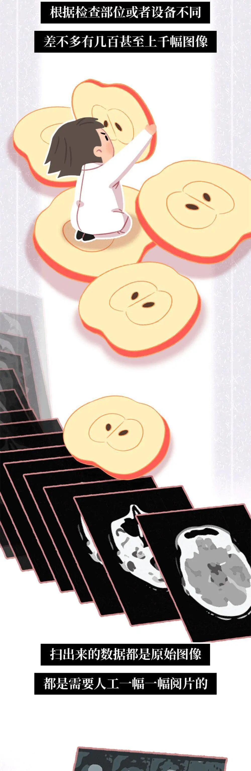 x光机为什么影像科诊断报告为什么那么慢？_https://www.jmylbn.com_新闻资讯_第9张