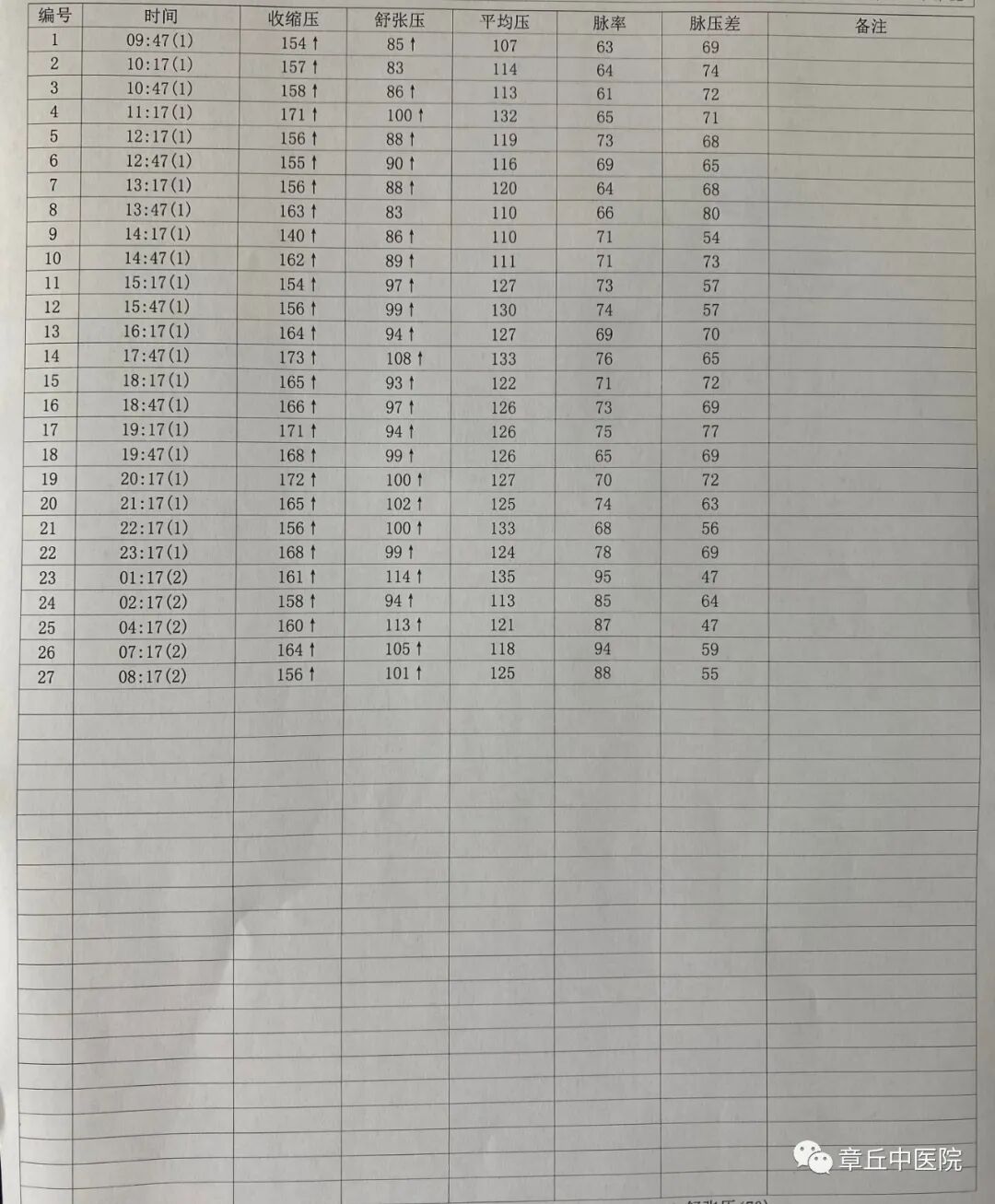 什么是同步心电图冠心病、高血压同时发作怎么办？同步动态心电血压二合一来帮您解决！_https://www.jmylbn.com_新闻资讯_第4张