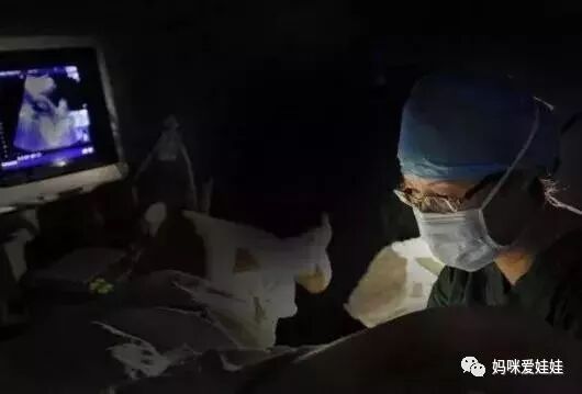 取卵针长什么样试管婴儿取卵的针有这么长长长的嘛？听说有人疼的打滚？_https://www.jmylbn.com_新闻资讯_第9张