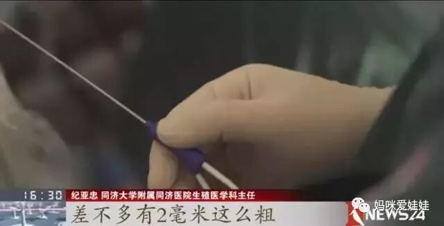 取卵针长什么样试管婴儿取卵的针有这么长长长的嘛？听说有人疼的打滚？_https://www.jmylbn.com_新闻资讯_第8张