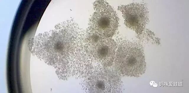 取卵针长什么样试管婴儿取卵的针有这么长长长的嘛？听说有人疼的打滚？_https://www.jmylbn.com_新闻资讯_第15张