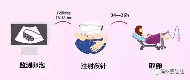 取卵针长什么样试管婴儿取卵的针有这么长长长的嘛？听说有人疼的打滚？_https://www.jmylbn.com_新闻资讯_第13张