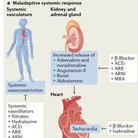 早读 | 心衰治疗即将进入新时代！自然子刊述评