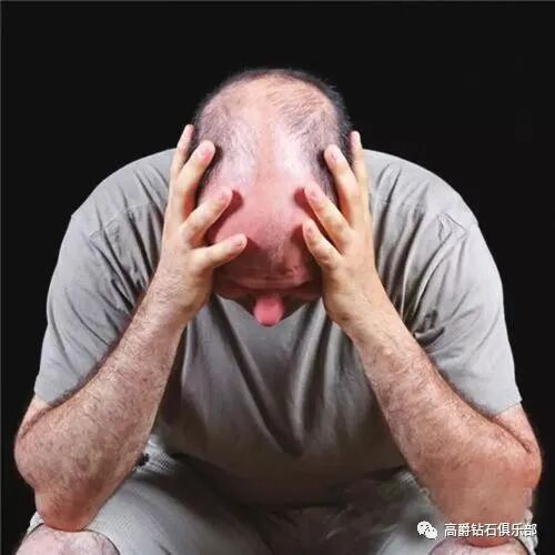 中国脱发者将突破3亿，我们究竟如何摆脱脱发困扰？试试SOMA