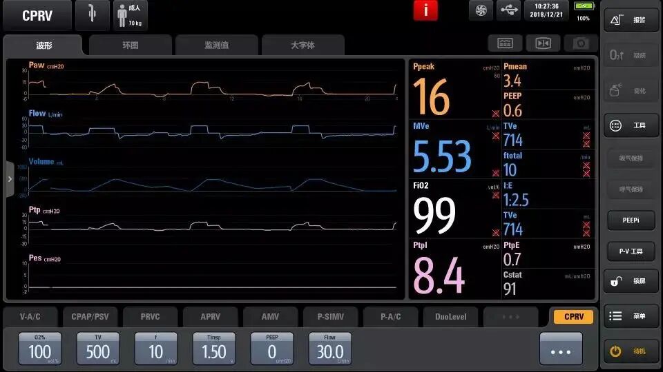 呼吸机吸呼比怎么调心肺复苏时呼吸机参数的调节_https://www.jmylbn.com_新闻资讯_第5张