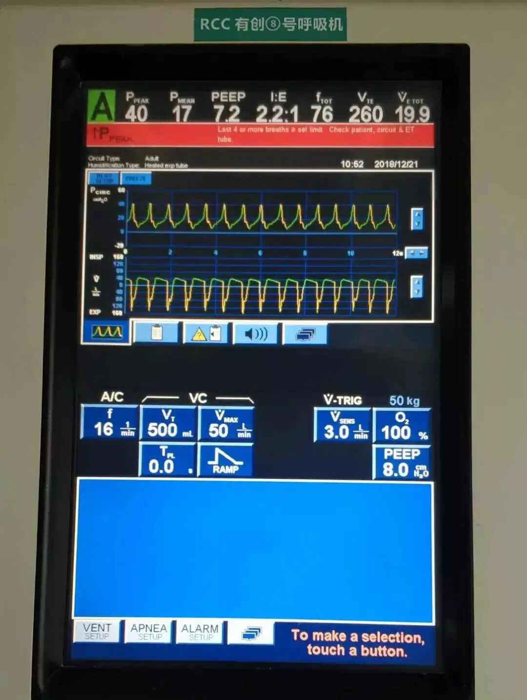呼吸机吸呼比怎么调心肺复苏时呼吸机参数的调节_https://www.jmylbn.com_新闻资讯_第1张