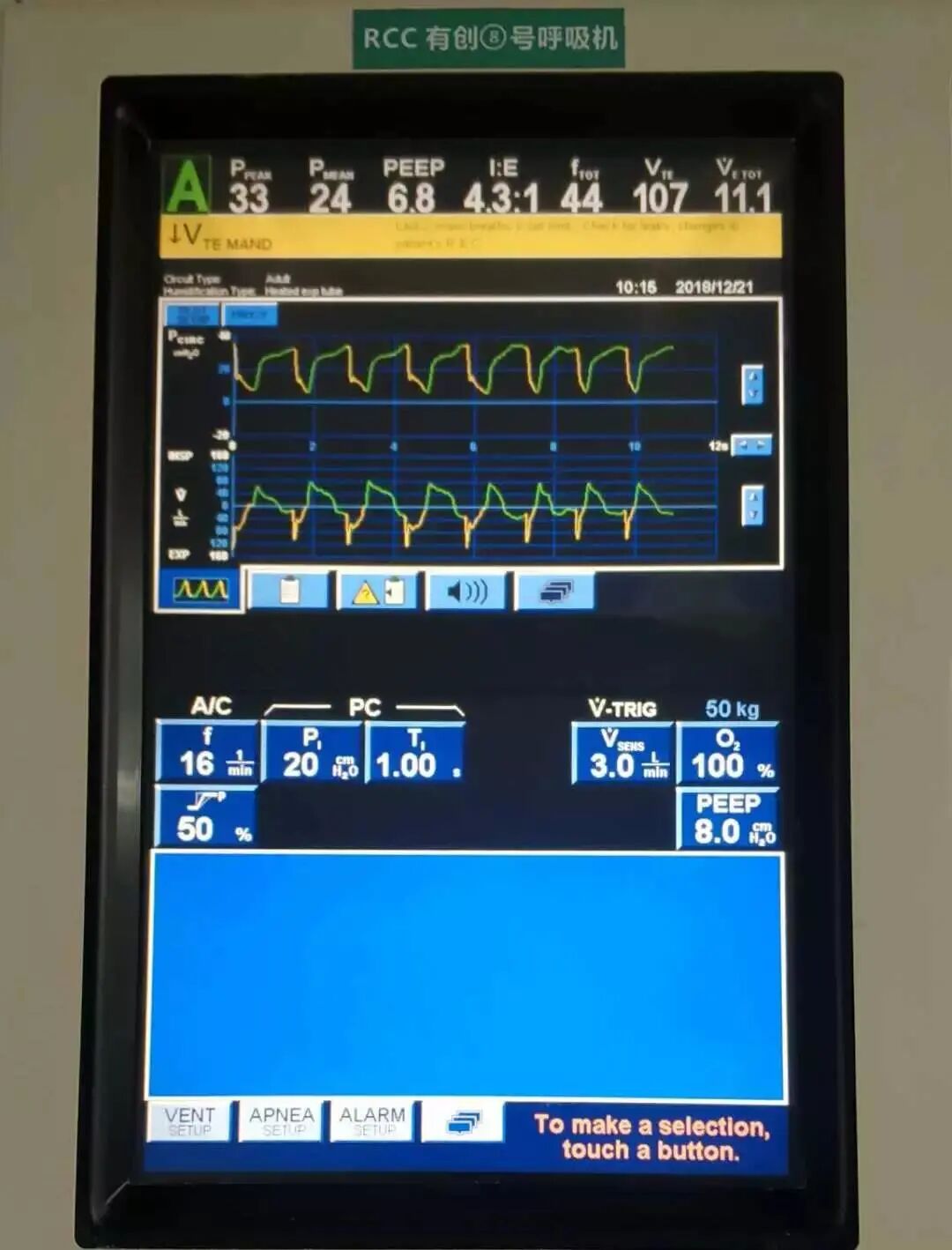 呼吸机吸呼比怎么调心肺复苏时呼吸机参数的调节_https://www.jmylbn.com_新闻资讯_第2张