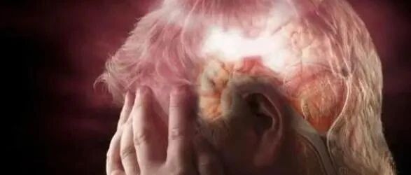 脑梗是“拖”出来的？睡觉时若有这3个现象，尽量引起重视