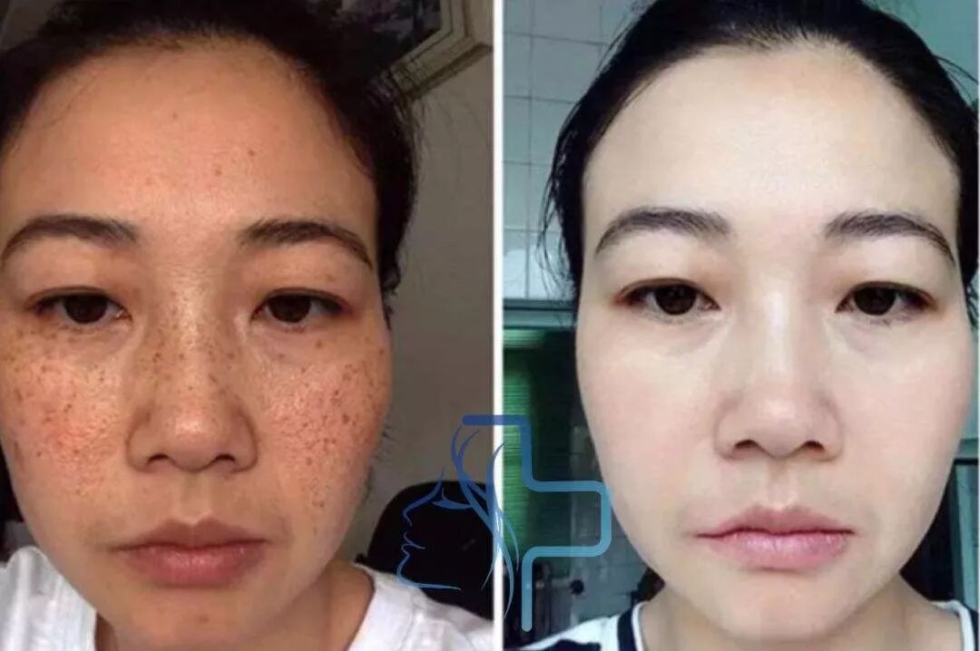 |曝光！90后小伙在湖北出名了！把鲜花当面膜敷，皮肤白嫩得让女生受不了！