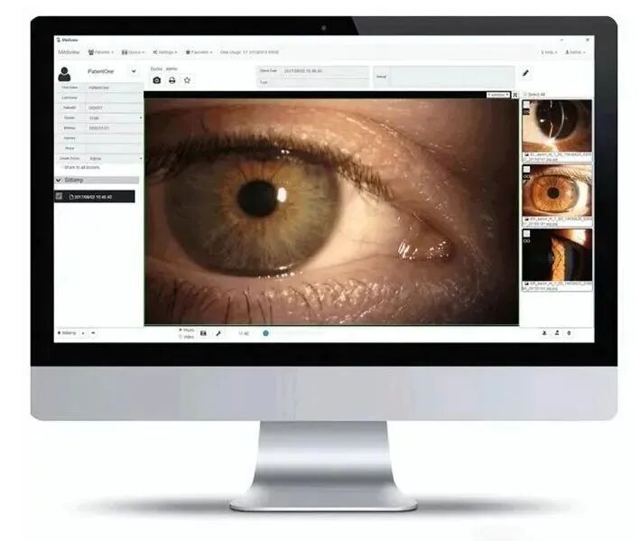 数码裂隙灯怎么充电【诚招省市等各级代理商】口袋里的S150手持裂隙灯——便捷眼科检查神器_https://www.jmylbn.com_新闻资讯_第14张