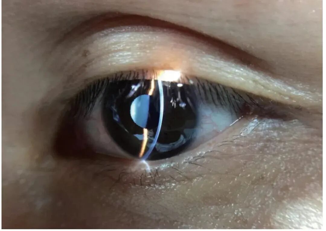 数码裂隙灯怎么充电【诚招省市等各级代理商】口袋里的S150手持裂隙灯——便捷眼科检查神器_https://www.jmylbn.com_新闻资讯_第11张