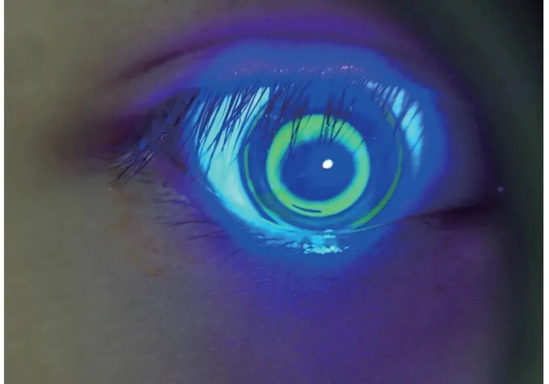 数码裂隙灯怎么充电【诚招省市等各级代理商】口袋里的S150手持裂隙灯——便捷眼科检查神器_https://www.jmylbn.com_新闻资讯_第12张