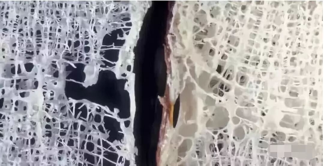 肽与骨关节疾病