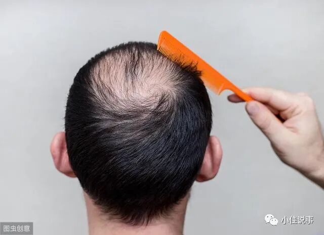 脱发严重？有可能是缺乏6种营养，补充帮助缓解，吃一种也好