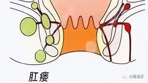 洗肛门怎么洗你有“洗肛门”的习惯吗？洗干净有什么好处？别害羞，看看怎么洗_https://www.jmylbn.com_新闻资讯_第8张