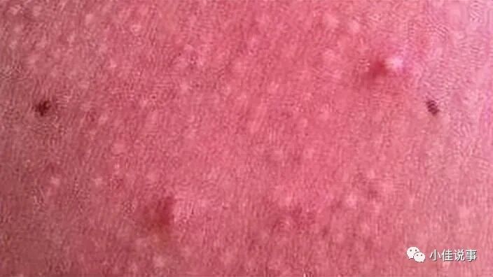 洗肛门怎么洗你有“洗肛门”的习惯吗？洗干净有什么好处？别害羞，看看怎么洗_https://www.jmylbn.com_新闻资讯_第11张