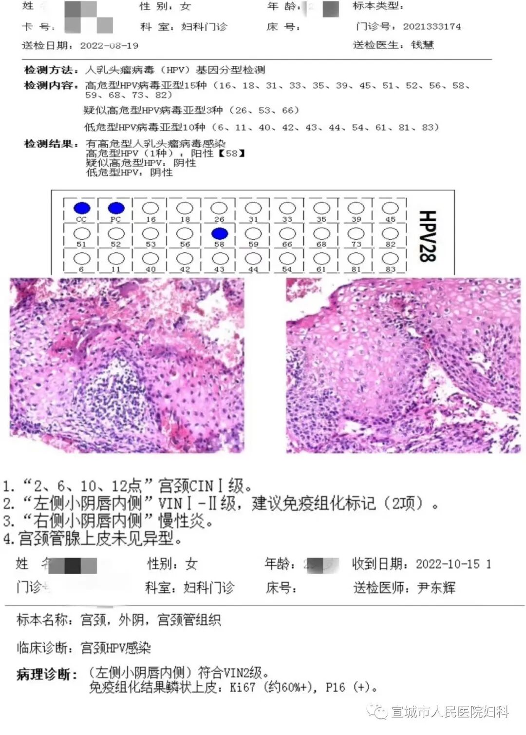 宫颈光是什么意思妇科的神秘之光——CO2激光，宫颈治疗“神器”_https://www.jmylbn.com_新闻资讯_第7张