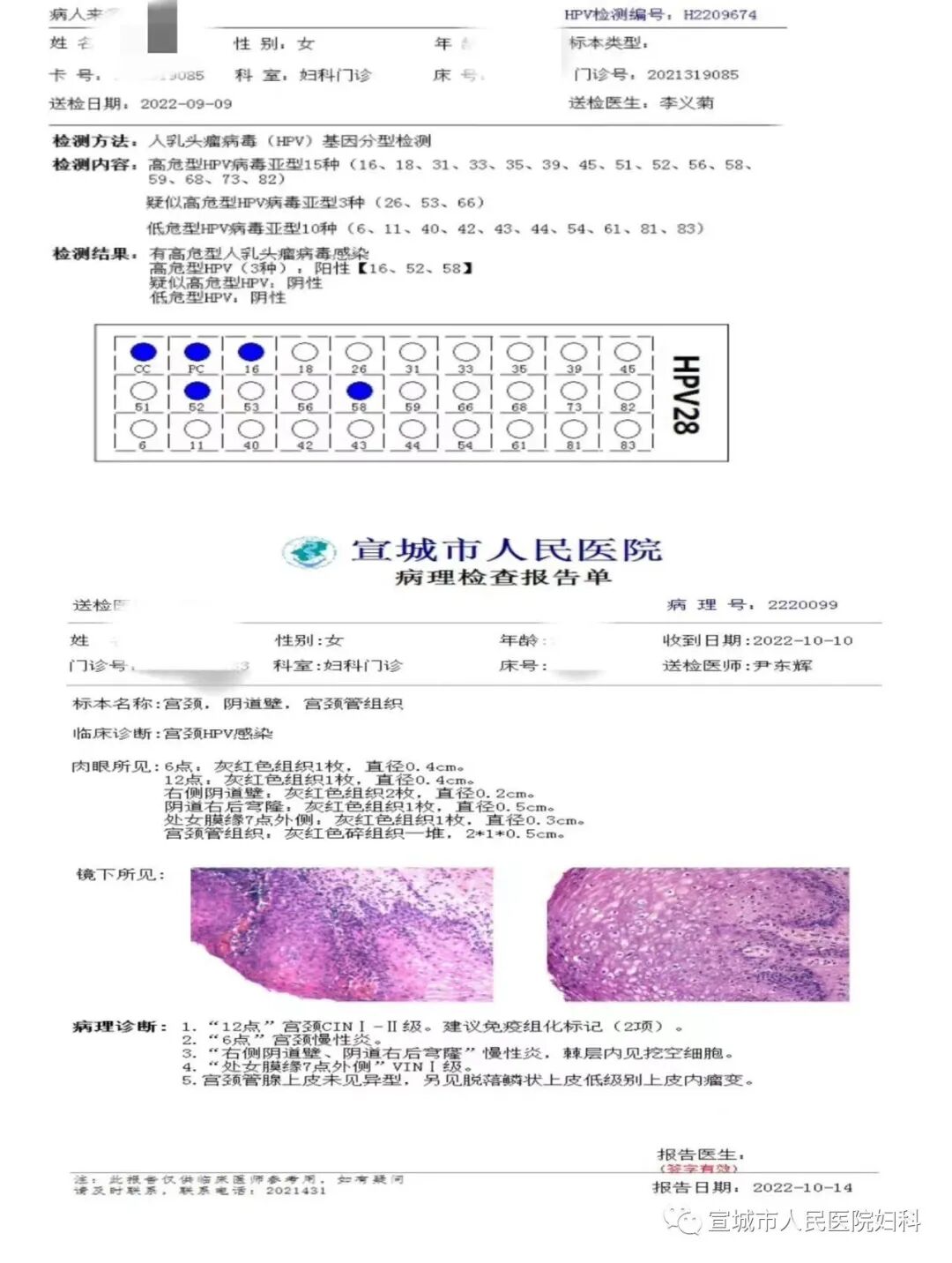 宫颈光是什么意思妇科的神秘之光——CO2激光，宫颈治疗“神器”_https://www.jmylbn.com_新闻资讯_第6张