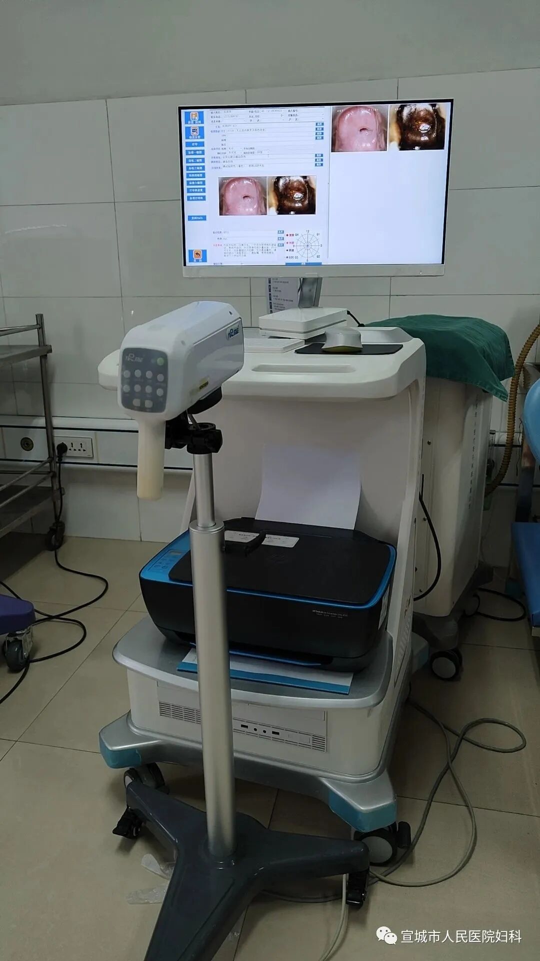 宫颈光是什么意思妇科的神秘之光——CO2激光，宫颈治疗“神器”_https://www.jmylbn.com_新闻资讯_第2张