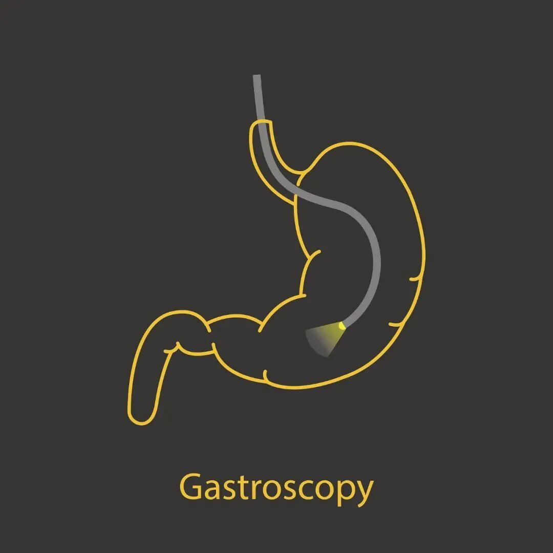 内窥镜市场怎么样一次性内窥镜技术突破与市场变革_https://www.jmylbn.com_新闻资讯_第7张