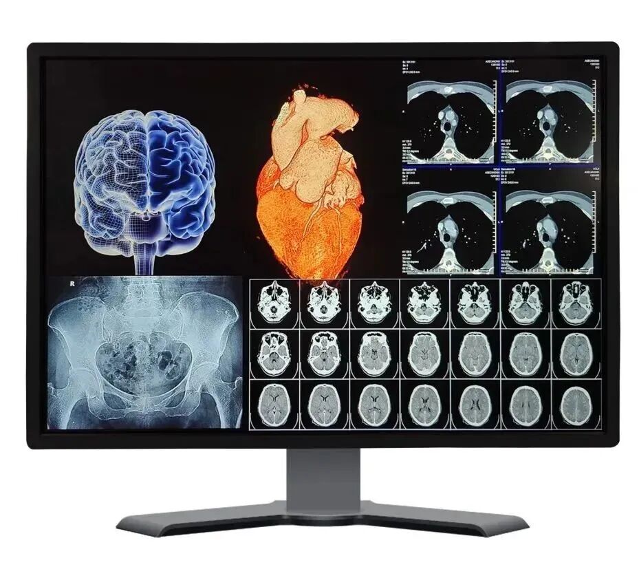 低频笔记本为什么SID 2022 ｜ 京东方、维信诺、天马、TCL华星、三星显示、LGD、友达、群创展示最新创新成果_https://www.jmylbn.com_新闻资讯_第28张