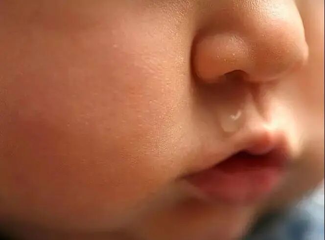 怀疑自己得了过敏性鼻炎，如何确诊呢？