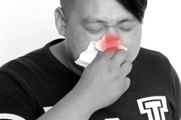 鼻炎久拖引后患 早查早调理是“上策”