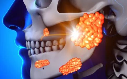 鼻窦炎反复发作从饮食开始做起！