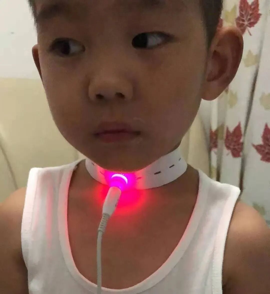 半导体激光治疗仪怎么样半导体激光治疗仪如何使用，什么是基础治疗，外照穴位说明！_https://www.jmylbn.com_新闻资讯_第9张