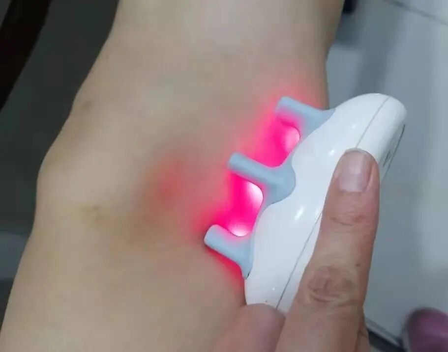 半导体激光治疗仪怎么样半导体激光治疗仪如何使用，什么是基础治疗，外照穴位说明！_https://www.jmylbn.com_新闻资讯_第15张
