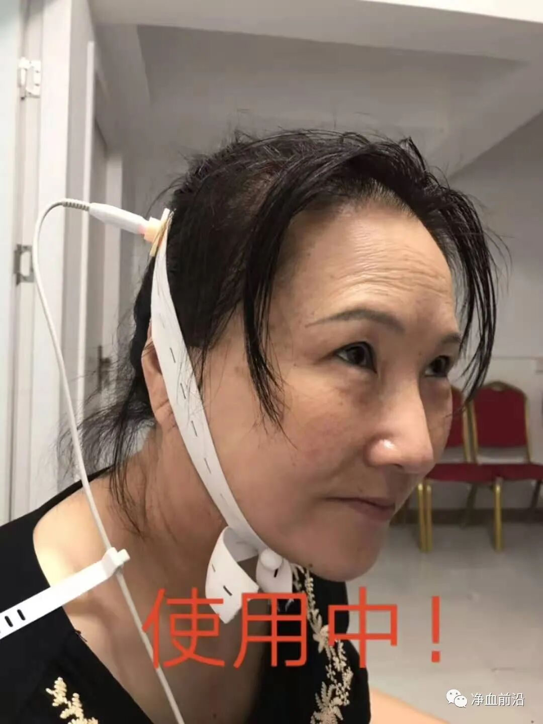 半导体激光治疗仪怎么样半导体激光治疗仪如何使用，什么是基础治疗，外照穴位说明！_https://www.jmylbn.com_新闻资讯_第19张