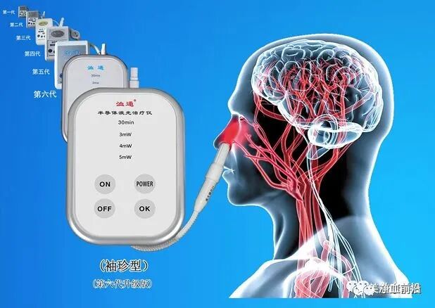 半导体激光治疗仪怎么样半导体激光治疗仪如何使用，什么是基础治疗，外照穴位说明！_https://www.jmylbn.com_新闻资讯_第2张