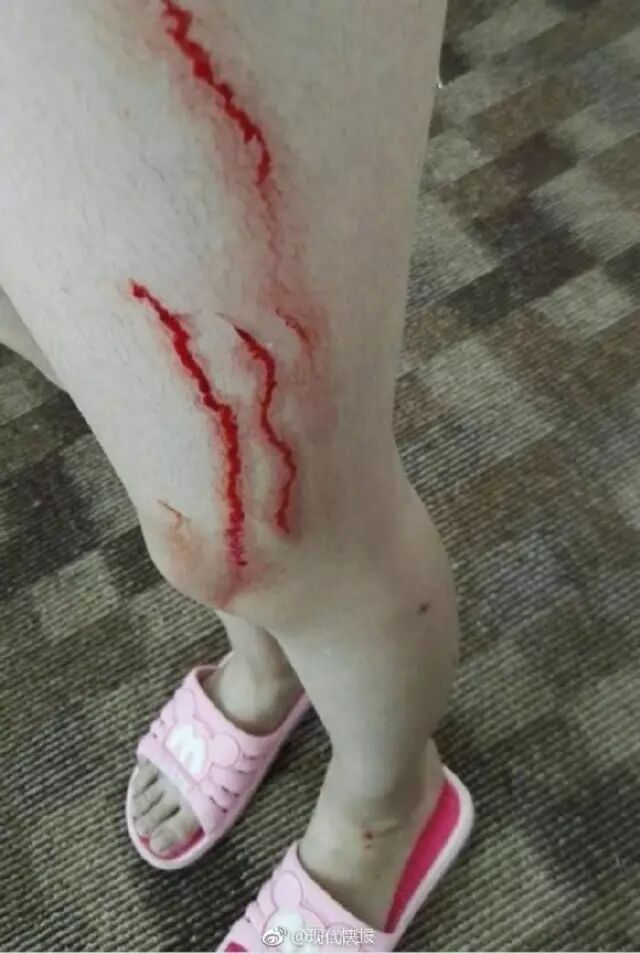 酒店浴室玻璃自爆女孩浑身是血快检查一下你家玻璃会不会炸