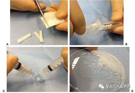 明胶在血管怎么降解明胶海绵的制备_https://www.jmylbn.com_新闻资讯_第3张