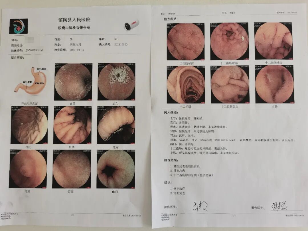 电子胃镜镜是什么【新技术】做胃镜，从此不再“畏镜”！胶囊胃镜来啦_https://www.jmylbn.com_新闻资讯_第3张